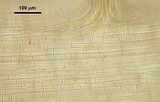 Cellule corticali in visione superficiale